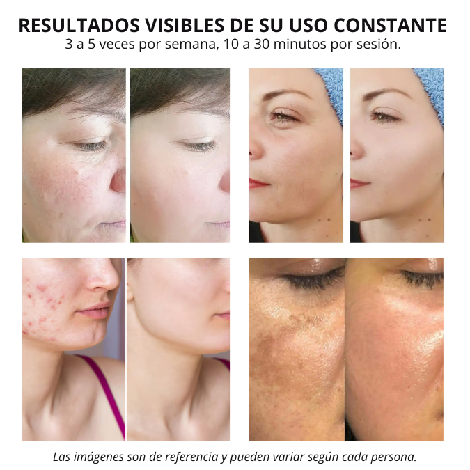 Mascara Facial LED con cuello | Tecnología de belleza profesional, sin salir de casa